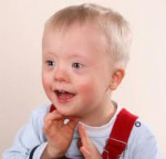 baby with Down’s Syndrome
