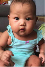 Baby Lian, saved from abortion by WRWF Save a Girl campaign