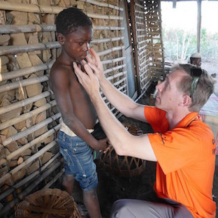 Leprosy checkup in Mozambique