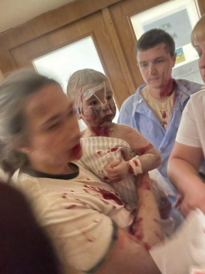 Children injured in Russian attack on Kyiv hospital. Image: Suspilne