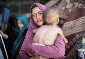 Mother holds two-year-old son, suffering from malnutrition, losing more than seven pounds in just a few months. Photo: Diaa Ostaz