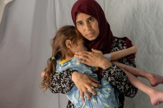 ©WHO A 7-year-old with severe acute malnutrition and dehydration at field hospital in southern Gaza in April amid looming famine in north.