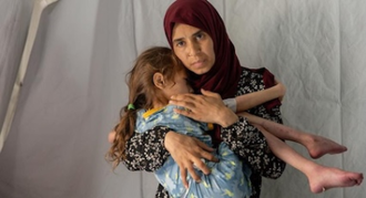 ©WHO A 7-year-old with severe acute malnutrition and dehydration at field hospital in southern Gaza in April amid looming famine in north.