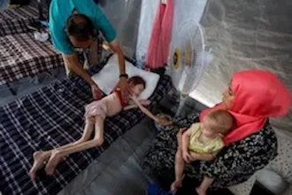 Scenes of severe malnutrition in Gaza